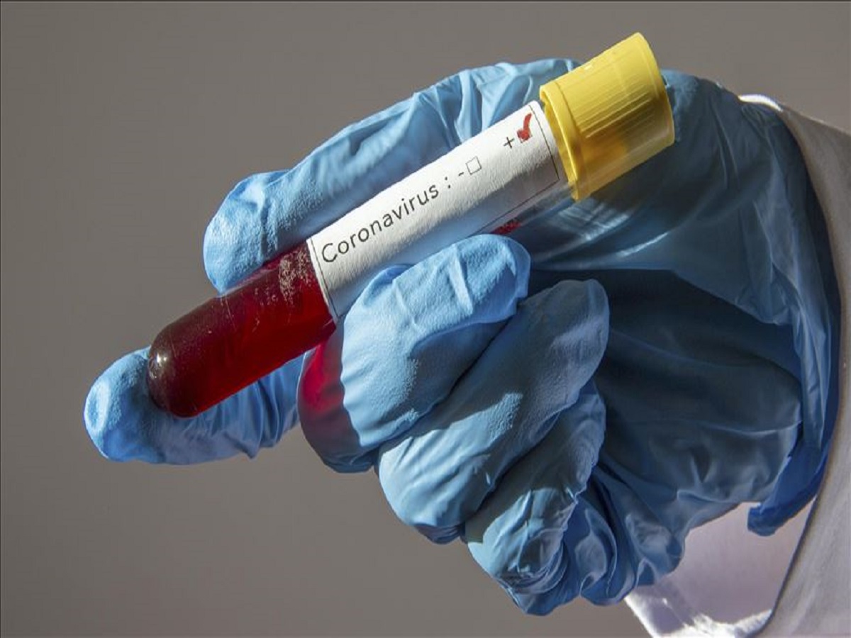 طرح کاهش زنجیره انتقال بیماری کرونا در خراسان رضوی از امروز اجرا می شود