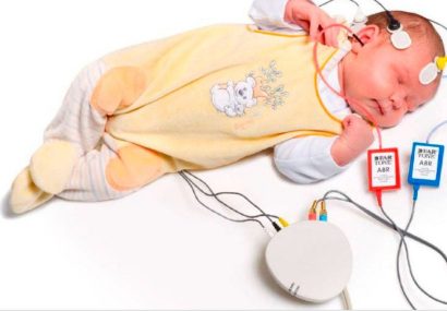 شناسایی بیش از ۸۰ نوزاد با اختلال شنوایی در سال ۱۴۰۰ در نیشابور￼